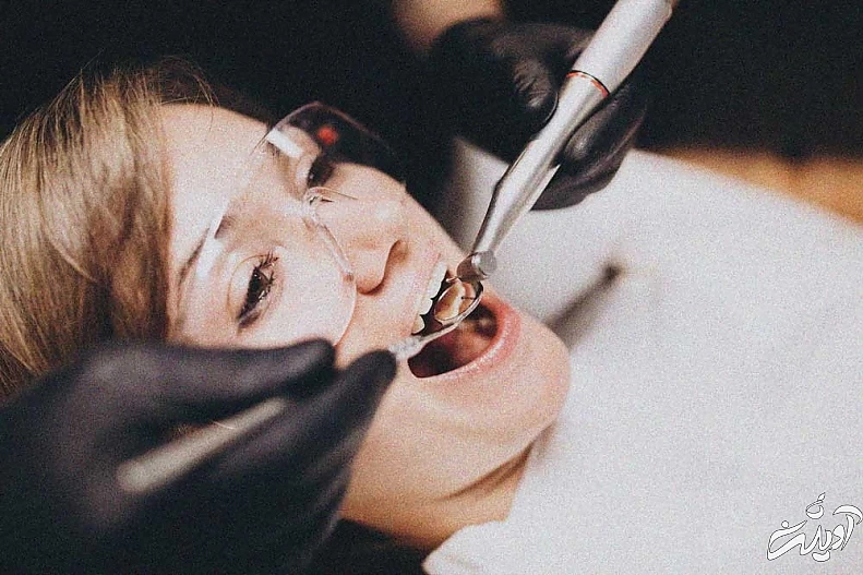 لمینت زیباتر است یا کامپوزیت؟ مسئله این است!